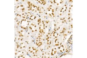 Immunohistochemistry of paraffin-embedded human gastric cancer using H4K8ac antibody (ABIN7267747) at dilution of 1:100 (40x lens).