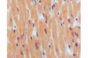 Immunohistochemistry (IHC) image for anti-Brain Natriuretic Peptide (BNP) antibody (ABIN2464019) (BNP anticorps)
