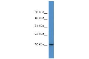 WB Suggested Anti-DNAJC19 Antibody Titration: 0. (DNAJC19 anticorps  (C-Term))