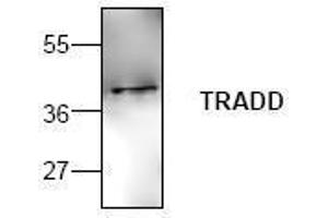 Image no. 1 for anti-TNFRSF1A-Associated Via Death Domain (TRADD) antibody (ABIN127191) (TRADD anticorps)