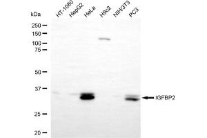 Western blotting analysis using IGFBP2 antibody (ABIN7799054).