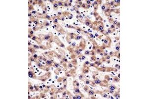 Immunohistochemistry analysis in formalin fixed and paraffin embedded human liver tissue reacted with HTATIP2 Antibody (N-term) followed which was peroxidase conjugated to the secondary antibody and followed by AB staining.
