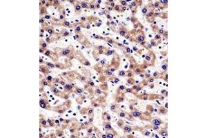Immunohistochemistry analysis in formalin fixed and paraffin embedded human liver tissue reacted with HTATIP2 Antibody (N-term) followed which was peroxidase conjugated to the secondary antibody and followed by AB staining. (HIV-1 Tat Interactive Protein 2, 30kDa (HTATIP2) (AA 44-74), (N-Term) anticorps)