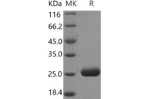 Western Blotting (WB) image for Prolactin Family 2, Subfamily A, Member 1 (PRL2A1) protein (His tag) (ABIN7321062)