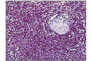 Immunohistochemistry (IHC) image for anti-Cyclin-Dependent Kinase 6 (CDK6) antibody (ABIN781963)