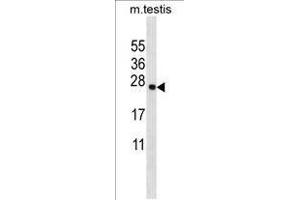 TMM18 Antibody (Center) western blot analysis in mouse testis tissue lysates (35 µg/lane).
