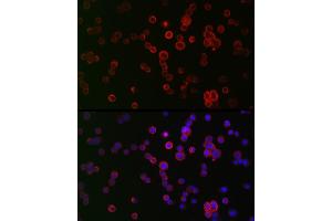 Immunofluorescence analysis of HT-29 cells using NOX1 Rabbit pAb (ABIN6133827, ABIN6144746, ABIN6144748 and ABIN6215916) at dilution of 1:50 (40x lens). (NOX1 anticorps  (AA 200-300))