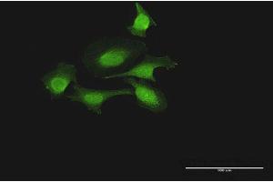 Immunofluorescence of purified MaxPab antibody to FOXJ2 on HeLa cell. (Forkhead Box J2 anticorps  (AA 1-574))