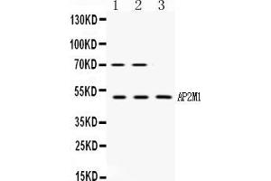 Western blot analysis of AP2M1 expression in rat kidney extract ( Lane 1), NIH3T3 whole cell lysates ( Lane 2) and MCF-7 whole cell lysates ( Lane 3).