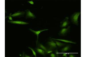Immunofluorescence of purified MaxPab antibody to S100A7 on HeLa cell. (S100A7 anticorps  (AA 1-101))