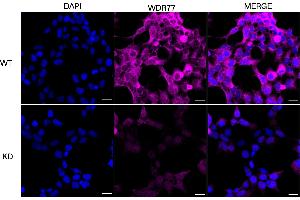 Immunocytochemical staining of HeLa cells using WDR77 antibody (ABIN7800857), 1:1,000), Top panel: wild-type (WT), Bottom panal: WDR77 shRNA knockdown (KD). (WDR77 anticorps)