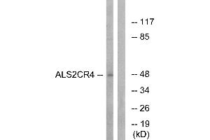 Western blot analysis of extracts from Jurkat cells, using ALS2CR4 antibody. (TMEM237 anticorps)