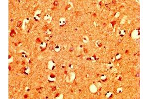 IHC image of ABIN7160478 diluted at 1:400 and staining in paraffin-embedded human brain tissue performed on a Leica BondTM system. (MZF1 anticorps  (AA 186-354))