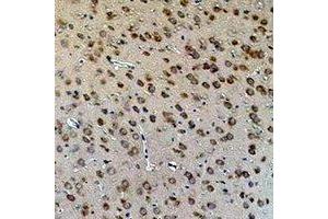 Immunohistochemical analysis of Aquaporin 4 staining in rat brain  formalin fixed paraffin embedded tissue section. (Aquaporin 4 anticorps)