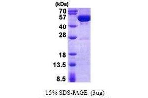 Figure annotation denotes ug of protein loaded and % gel used. (GDA Protéine)