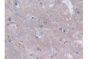 Detection of CYGB in Rat Spinal cord Tissue using Polyclonal Antibody to Cytoglobin (CYGB)