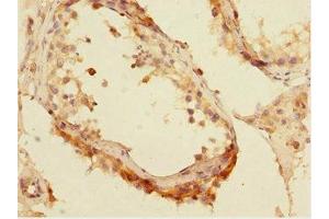 Immunohistochemistry of paraffin-embedded human testis tissue using ABIN7165192 at dilution of 1:100 (CBFA2T2 anticorps  (AA 325-604))