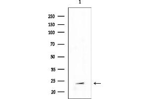 anti-Tetraspanin 9 (TSPAN9) (Internal Region) antibody