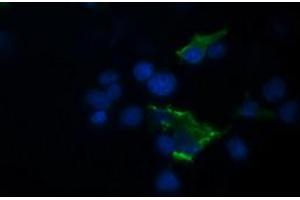 Image no. 10 for anti-Tripartite Motif Containing 44 (TRIM44) antibody (ABIN1501505) (TRIM44 anticorps)