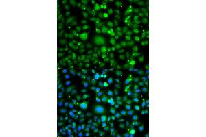 Immunofluorescence analysis of MCF-7 cells using TEK antibody. (TEK anticorps)