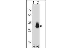Western blot analysis of CEAC (arrow) using rabbit polyclonal CEAC Antibody (C-term) (ABIN657776 and ABIN2846751).