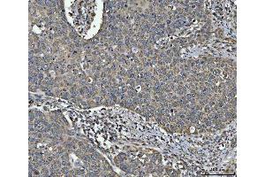 IHC analysis of NDUFV2 using anti-NDUFV2 antibody (ABIN7599154). (NDUFV2 anticorps  (AA 1-249))