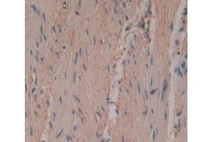 Used in DAB staining on fromalin fixed paraffin- embedded rectum skeletal muscle tissue