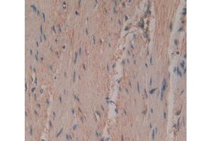 Used in DAB staining on fromalin fixed paraffin- embedded rectum skeletal muscle tissue