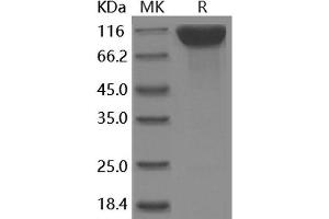 Western Blotting (WB) image for CD6 (CD6) (Active) protein (Fc Tag) (ABIN7317120) (CD6 Protein (CD6) (Fc Tag))