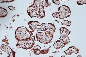 Immunohistochemistry of paraffin-embedded human placenta using RanG Rabbit mAb (ABIN7269846) at dilution of 1:100 (40x lens).