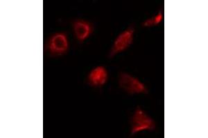 anti-ALX Homeobox 3 (ALX3) (Internal Region) antibody