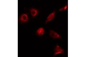ABIN6274131 staining 293 cells by IF/ICC. (ALX3 anticorps  (Internal Region))