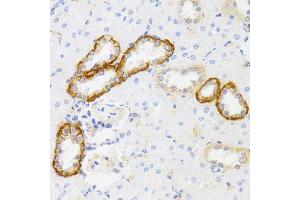 Immunohistochemistry of paraffin-embedded rat kidney using MYO5A antibody (ABIN6003562) at dilution of 1/100 (40x lens).