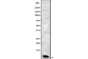 Western blot analysis of Defensin β1 using Jurkat whole cell lysates