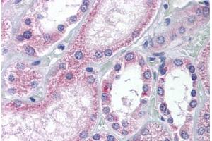 Human Kidney (formalin-fixed, paraffin-embedded) stained with AADAT antibody ABIN239801 at 5 ug/ml followed by biotinylated goat anti-rabbit IgG secondary antibody ABIN481713, alkaline phosphatase-streptavidin and chromogen.