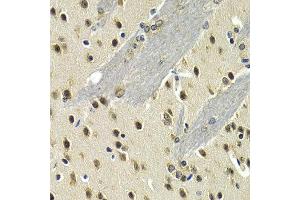 Immunohistochemistry of paraffin-embedded mouse brain using MAX antibody at dilution of 1:200 (400x lens). (MAX anticorps)