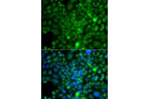 Immunofluorescence analysis of A549 cells using RRAGA antibody (ABIN5974959).