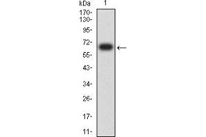 Western blot analysis using KRT13 mAb against human KRT13 (AA: 104-458) recombinant protein. (Cytokeratin 13 anticorps  (AA 104-458))