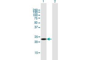 Western Blot analysis of ANKRD7 expression in transfected 293T cell line by ANKRD7 MaxPab polyclonal antibody. (ANKRD7 anticorps  (AA 1-201))