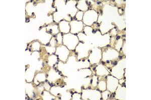 Immunohistochemistry of paraffin-embedded mouse lung using IFRD1 antibody.