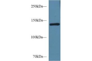 Detection of SEMA4D in Mouse Serum using Polyclonal Antibody to Semaphorin 4D (SEMA4D) (SEMA4D/CD100 anticorps  (AA 502-636))