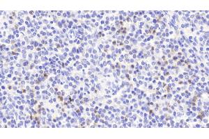 Detection of S100A12 in Human Spleen Tissue using Polyclonal Antibody to S100 Calcium Binding Protein A12 (S100A12)