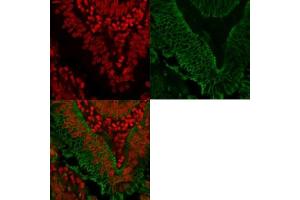 Protein array validation of the anti-EpCAM antibody: Analysis of HuProt(TM) microarray containing more than 19,000 full-length human proteins using the anti-EpCAM antibody (clone EGP40/1372).