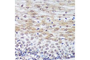 Immunohistochemistry of paraffin-embedded Human esophageal using PSME4 Rabbit pAb  at dilution of 1:100 (40x lens). (PSME4 anticorps  (AA 1634-1843))
