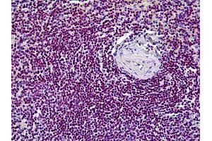 Immunohistochemistry (IHC) image for anti-Cyclin-Dependent Kinase 6 (CDK6) antibody (ABIN2471168) (CDK6 anticorps)