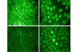 A431 cells were serum starved and treated with EGF (100 ng/ml) for 5 minutes, then fixed in 3.