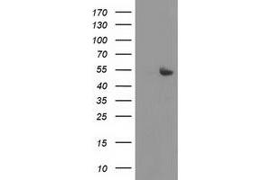 Western Blotting (WB) image for anti-Sedoheptulokinase (SHPK) antibody (ABIN1500920)