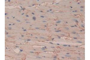 Detection of CD147 in Rat Heart Tissue using Polyclonal Antibody to Cluster Of Differentiation 147 (CD147)