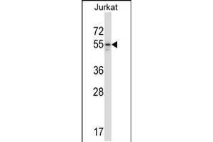 Western blot analysis in Jurkat cell line lysates (35ug/lane). (MAP2K7 anticorps  (AA 206-233))