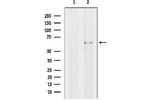 Western blot analysis of lysates from Hela cells, using MCCC2 Antibody.